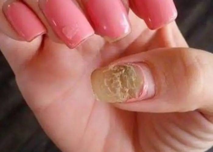 Dirt forming in acrylic nail