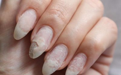 Why Do My Acrylic Nails Keep Popping Off?